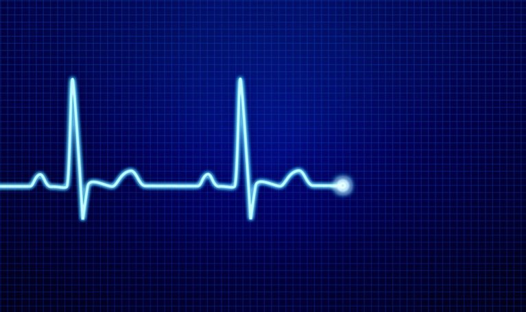  Image of an EKG pulse waveform.
